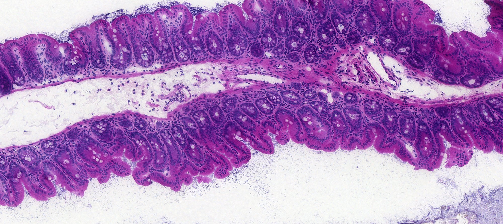 H&E-stained section of intestinal mucosa